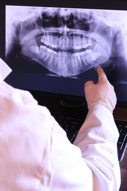 Best Emergency Wisdom Teeth Removal in Raceland, KY